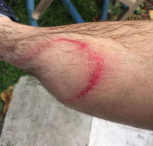 Danger de haute pression